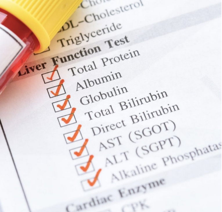 أنواع تحاليل وظائف الكبد